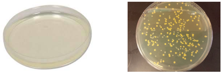 Photo of bacterial matter in a circle dish