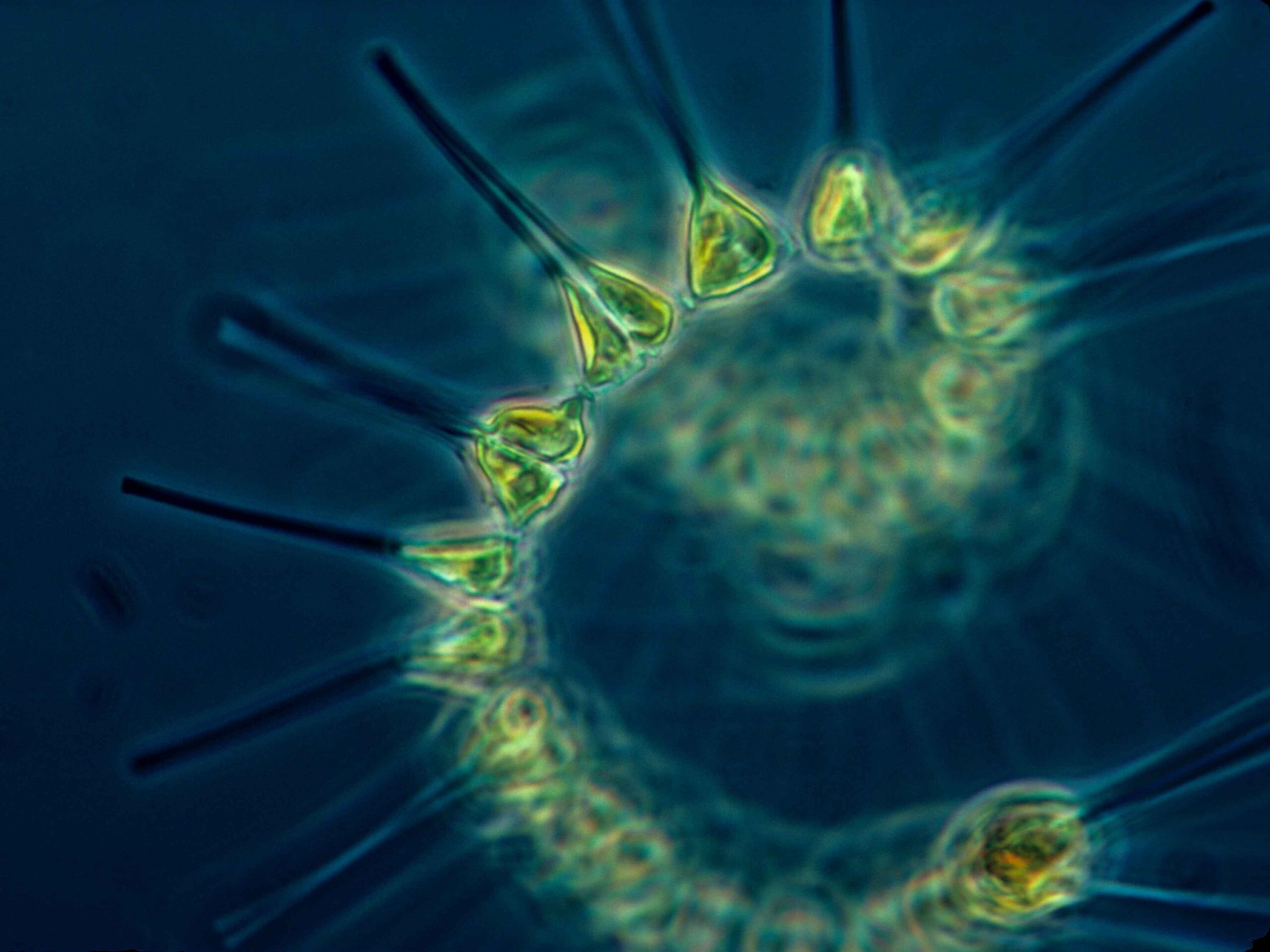 A coil image of Phytoplankton seen through a microscope