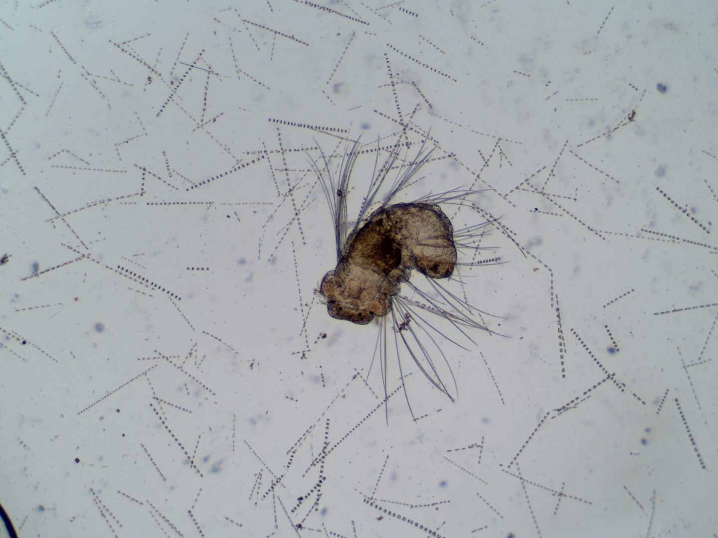Polychaete worm larvae in plankton sample